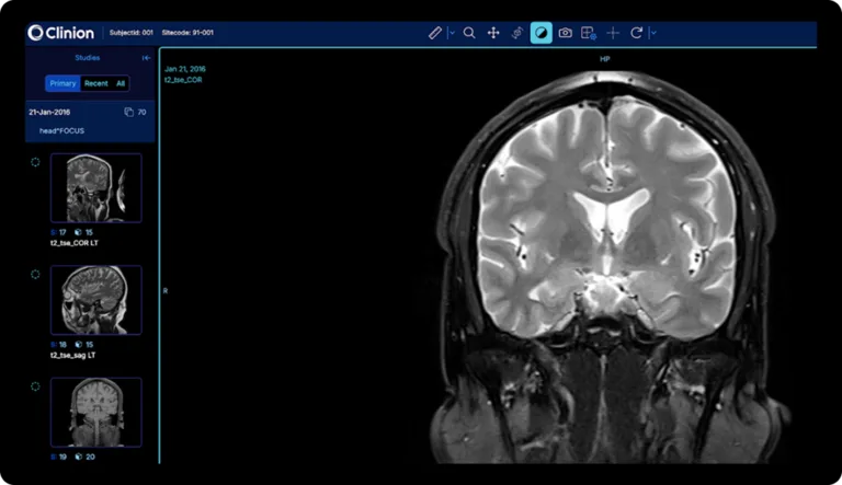 Clinion DICOM Medical Image Repository for Clinical Trials